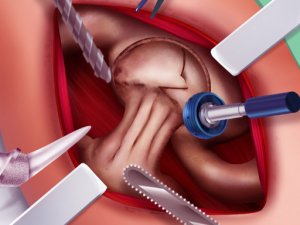 Princess Hips Surgery Online Game Medical Sim